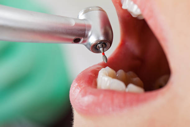Best Weekend Emergency Dentist in Basye, VA